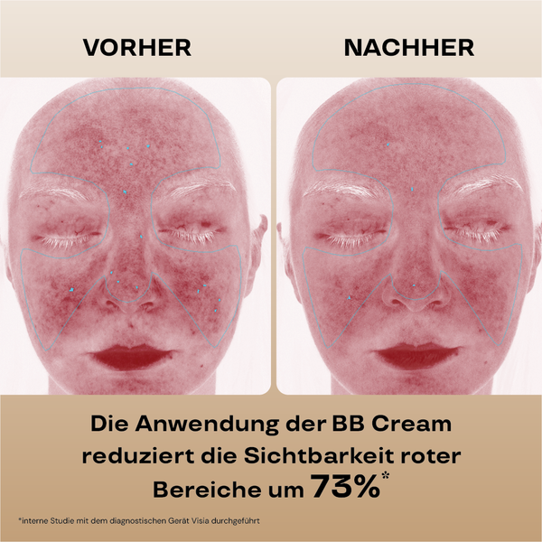 Feuchtigkeitsspendende BB Cream LSF 15 (310/Honey)